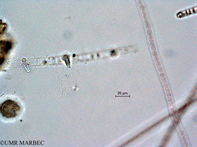 phyto/Scattered_Islands/all/COMMA April 2011/Chaetoceros sp8 et Richelia intracellularis (ancien Chaetoceros sp24-5)(copy)_thumb.jpg